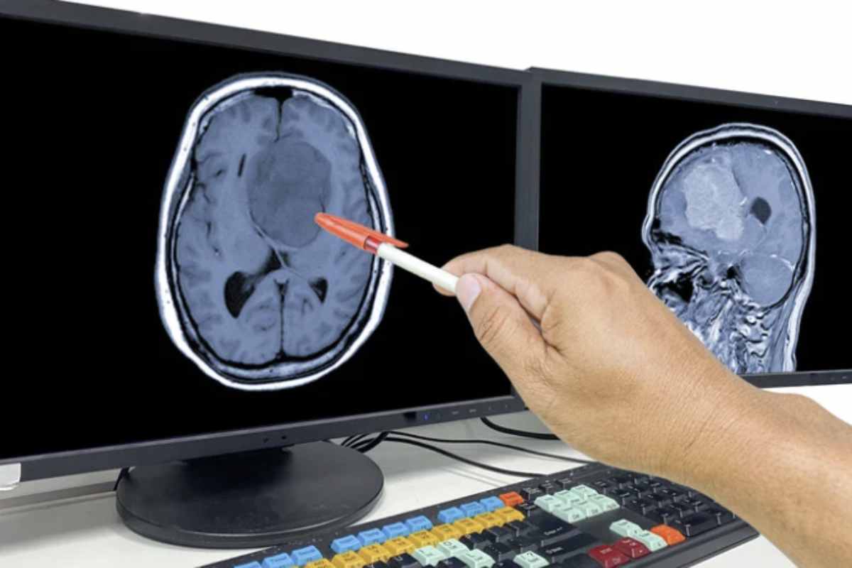 Dopo la diagnosi, Costa Fantis ha iniziato il trattamento previsto dal sistema sanitario pubblico britannico, che comprende cicli